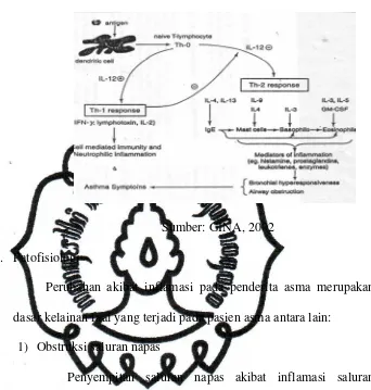 Gambar 1.1 Patogenesis Asma 
