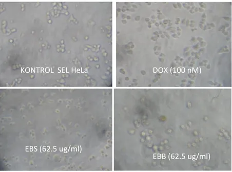 Gambar  4.2  Perbandingan  efek  penghambatan  pertumbuhan  sel  (aktifitas  antikanker)  karena  perlakuan  ekstrak  bawang  sabrang  (EBS),  ekstrak  benalu  belimbing  (EBB),  Doxsorubisin  pada  sel  kanker  HeLa  dengan  metode  reduksi  MTT