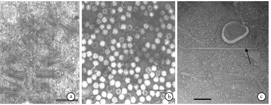 Gambar 2. Partikel virus nilam; badan inklusi PatMoV, skala bar = 500 nm (Natsuakinm (Natsuaki et al