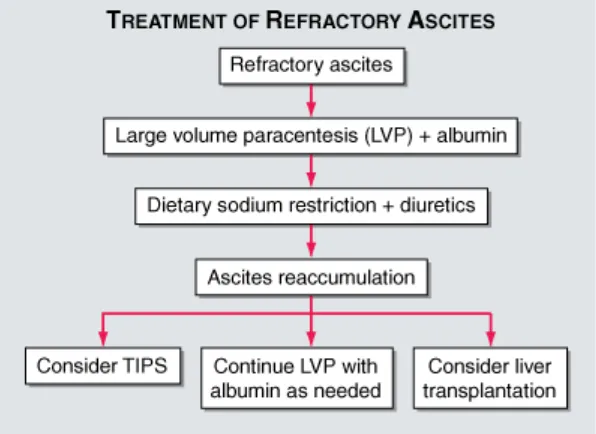 Gambar 4. Penanganan ascites refrakter.  Pada pasien yang mengalami azotemia karenapemberian diuretic, beberapa akan memerlukan paresintesis vlume-besar (LVP-largevolume paracentesis), dan beberapa lainnya dipertimbangkan untuk dilakukantransjugular intrah