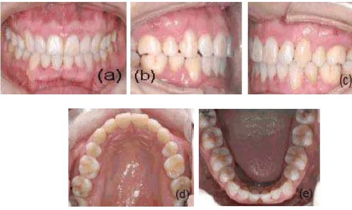 Gambar 2. Foto ekstra oral. (a) Foto frontal (bibir istirahat), (b) foto frontal Gambar 2