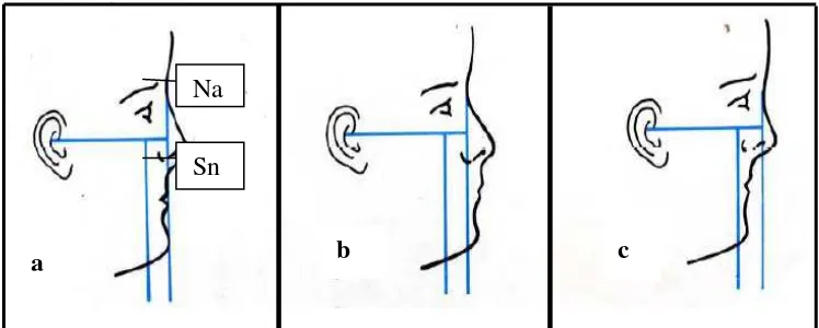 Gambar 10. (a) Average (lurus), (b) Anteface (cembung), (c) Retroface (cekung) 19 