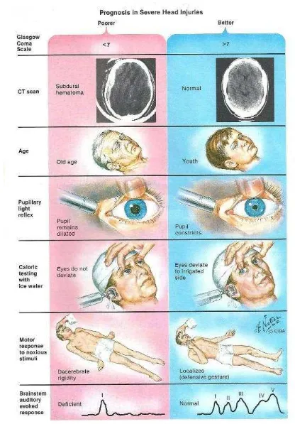 Gambar 9. Prognosis cedera kepala berat (Sumber: Netter)