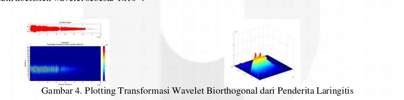 Gambar 4. Plotting Transformasi Wavelet Biorthogonal dari Penderita Laringitis 