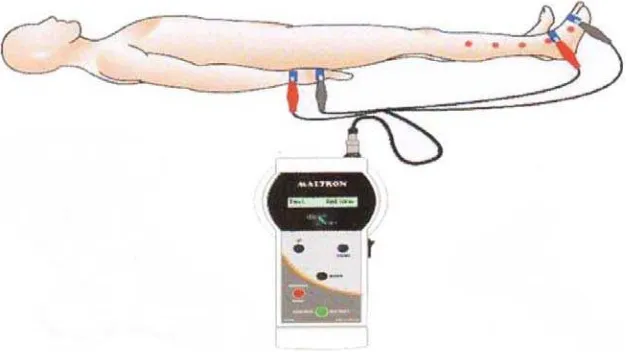Gambar 2.Teknik pengukuran komposisi tubuh dengan BIA