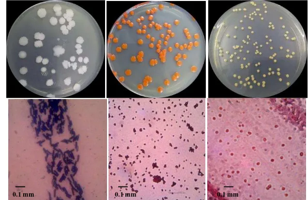 Tabel 1. Pengamatan morfologi isolat bakteri meliputi pengamatan koloni bakteri dan Karakteristik morfologi pada isolat bakteri BLSP-3, BLSP-4, dan BLBt disajikan pada pengamatan mikroskopis