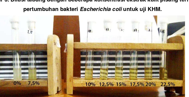 Gambar 1. Escherichia coli dengan pengecatan Gram perbesaran 1000x. Tampak pada ujung petunjuk bakteri gram negatif berbentuk batang berwarna merah yang menandakan bahwa bakteri tersebut adalah bakteri Escherichia coli