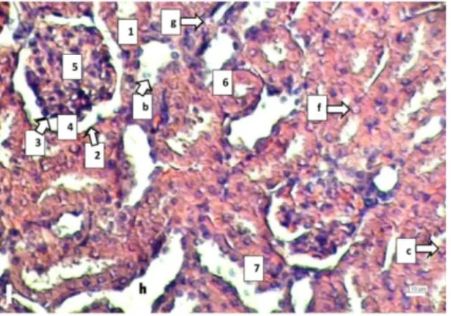 Gambar 9.   Struktur  Mikroanatomis  Korteks  Ginjal Tikus Putih (R. norvegicus)  Betina Galur Wistar Grup P 2  pada  Hari  ke-90  Perlakuan  Natrium  Nitrit