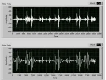 Gambar 3.3 Klasifikasi sinyal EEG 