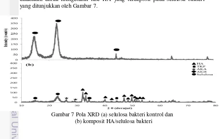 Gambar 7 Pola XRD (a) selulosa bakteri kontrol dan  
