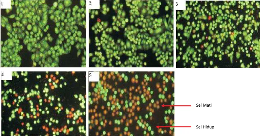 Gambar 3. Hasil Pengecatan sel Hela dengan acridine orange dan ethidium bromide (AO-EB) perbesaran 100x