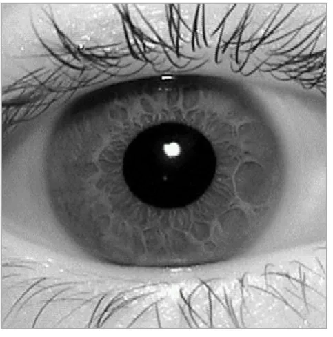 Figure 3 Iris Pattern 5