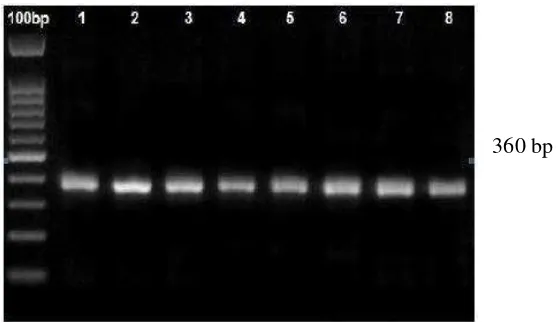 Gambar 9 Hasil analisis DGGE gen 16S rRNA. Kiri: Foto dari G:BOX dan Kanan: Interpretasi dari piranti lunak Phoretix 1D