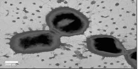 Gambar 1.Bakteri  Porphyromonas gingivalis9 