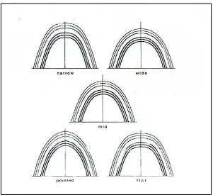 Gambar 2. Bentuk lengkung gigi menurut Raberin9 