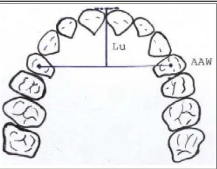 Gambar 5. Lebar intermolar bukal dan lingual      menurut Poosti dan Jalali27 