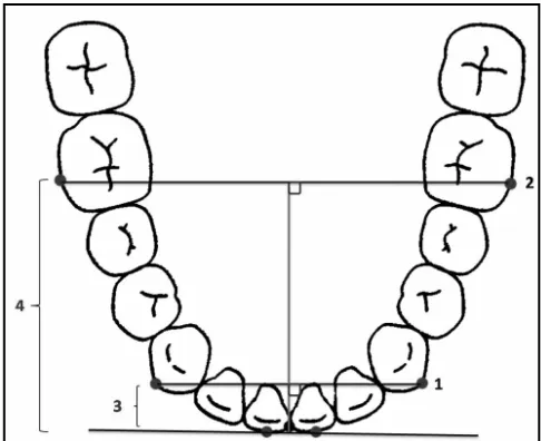 Gambar 8. Pengukuran panjang lengkung gigi rahang bawah  menurut Nojima.29 