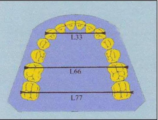 Gambar 9. Pengukuran lengkung gigi dalam arah transversal.9 