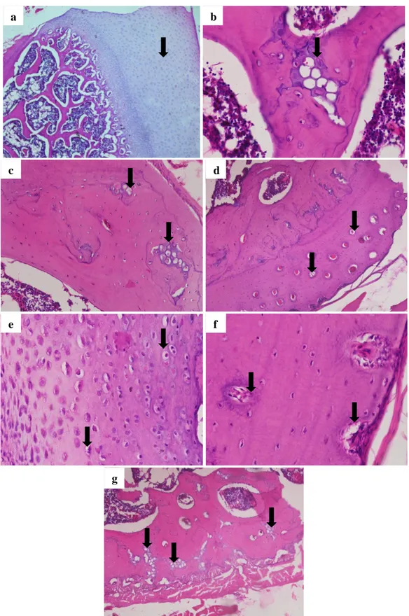 Gambar 1. (a) Os scapula terlihat zona ossifikasi normal; (b) Os humerus terlihat jaringan kartilago 