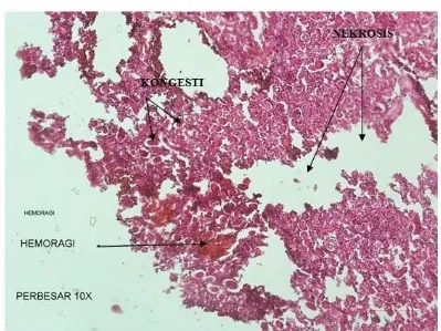 Gambar 1. Struktur Histopatologi Ginjal pada Konsentrasi 32 ml/L (Hemoragi pada ginjal, nekrosis pada   beberapa sel tubulus ginjal, kongesti pada pembuluh darah ginjal)  