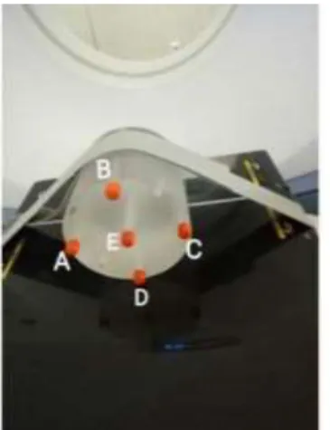 Gambar  1  menunjukan  ketika  posisi  detektor berada di A organ yang akan terkenai  sinar-X  meliputi  telinga  kanan  dan  pelipis  kanan 