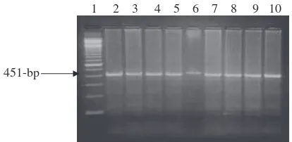 Fig. 6The electrophoretic pattern obtained after digestion ofladder marker. Lanes 2–9: Homozygous BB genotypes showedPCR ampliﬁed buffalo PIT-1 products with HinfI