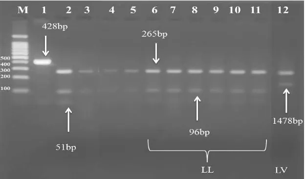 FIGURE 2:  electrophoresis on 1.5% agarose gel at5 volt/cmPCR products of bovine GH gene with size of 211 bp, amplified with primer GH2