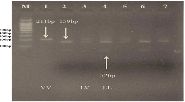 FIGURE 4: The digestion of PCR products (211) of GH gene with (100-1000), Lane (1): the undigested PCR products of the GH gene with size of 211bp which represented recessive VV genotype, Lanes 2, 4, 6, and 7: the digested form which represented the dominan