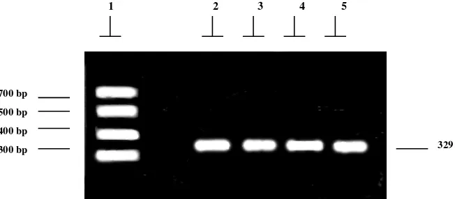 Gambar 2. Ketepatan kondisi reaksi PCR serta primer