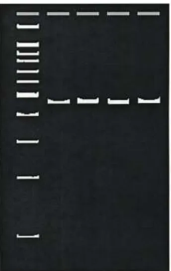 Figure 4. Representation of an agarose gel containing a 100 bp ladder (leftmost lane) and lanes showing 440 bp products from D-loop PCR amplification