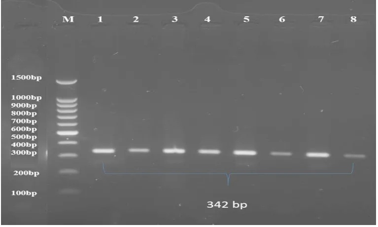 Figure (1): PCR products of bovine GH gene with size of 211 bp, amplified with primer GH