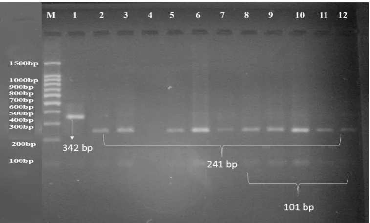 Figure (4): The digestion of PCR products (342) of GHR gene with AluIproduct was electrophoresis on 3% agarose gel at 5 volt/cm enzyme