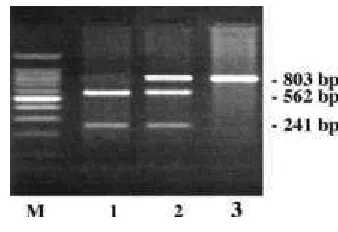 Figure 1. Genotypes observed after DraII 