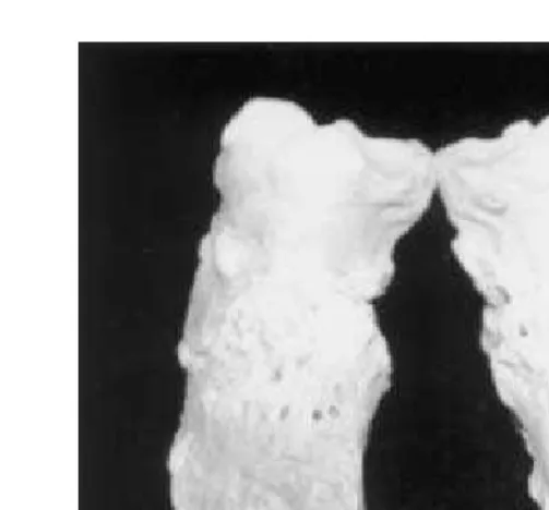 Figure 4.25. Abnormal third phalanx associated with corkscrew claw.