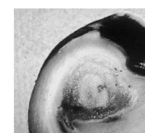 Figure 4.34. Screw claw: Displacement of the axial wall.