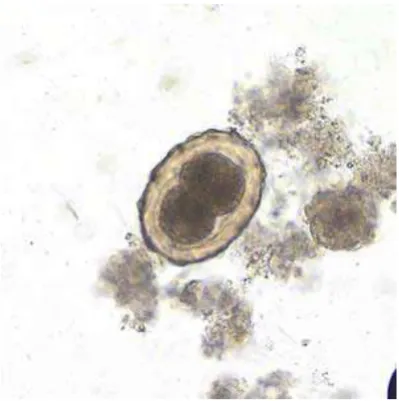 Gambar 2.2. Telur Ascaris lumbricoides yang Tidak Dibuahi (unfertilized) Sumber : http://www.cdc.gov/parasites/ascariasis/index.html 