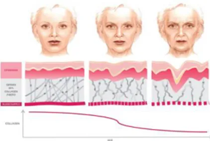 Gambar 1 Ilustrasi kulit wajah kekurangan kolagen [5] 