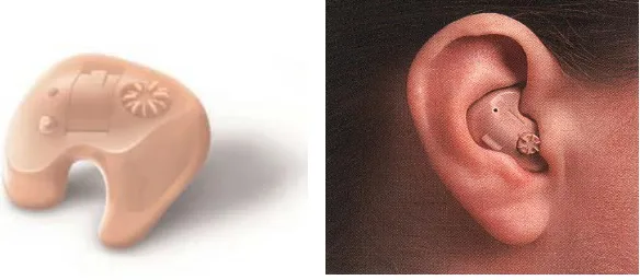 Gambar 3. 3 Alat Bantu Dengar di belakang telinga 