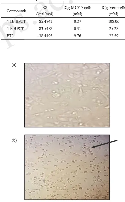 Figure 3. MCF-7 cells before administration of a test compound (4-Br-BPCT): living cells condition (a) and black arrow shows: MCF-7 cells after administration of a test compound (4-Br-BPCT) with a dose of 1000 μg/mL: the presence of dead cells after administration of a test compound (4-Br-BPCT) (b).��