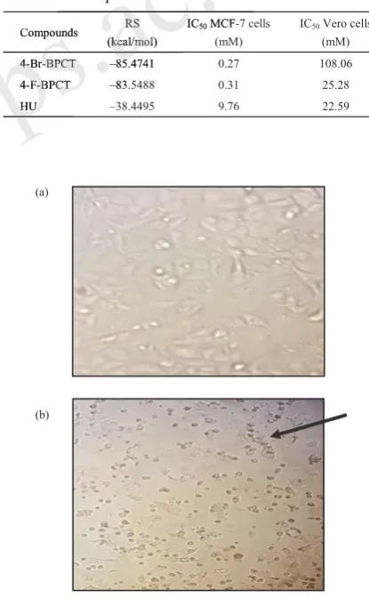 Figure 3. MCF-7 cells before administration of a test compound (4-Br-BPCT): living cells condition (a) and black arrow shows: MCF-7 cells after administration of a test compound (4-Br-BPCT) with a dose of 1000 μg/mL: the presence of dead cells after administration of a test compound (4-Br-BPCT) (b).��
