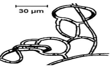 Gambar 12.  Arthrobotrys spp. menjerat nematoda 