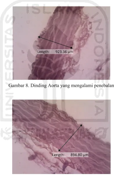Gambar 8. Dinding Aorta yang mengalami penebalan