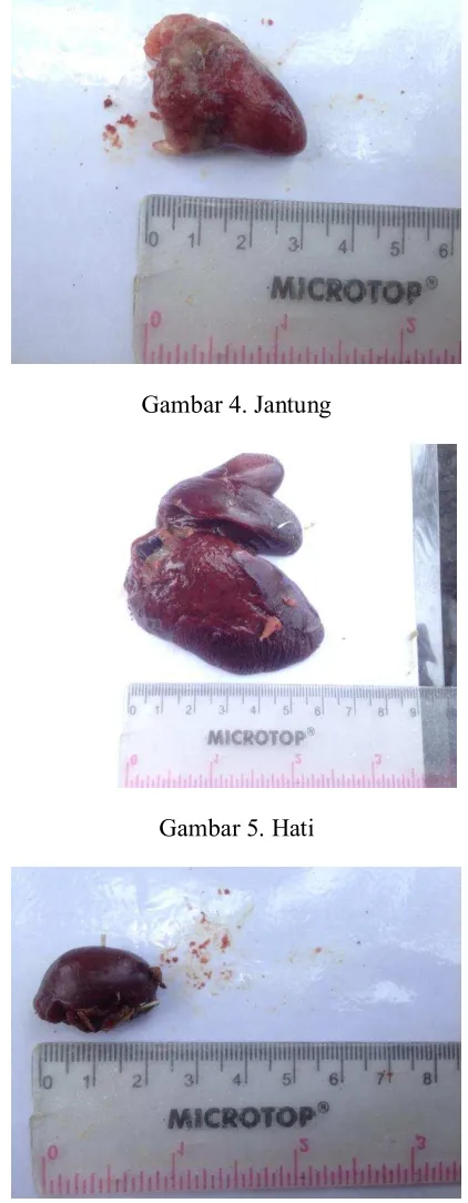 Gambar 4. Jantung 