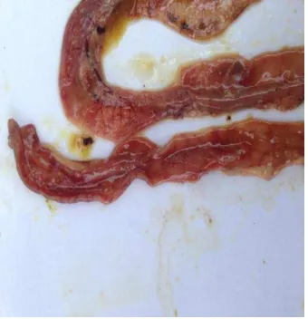 Gambar 7. Mukosa Ventrikulus 