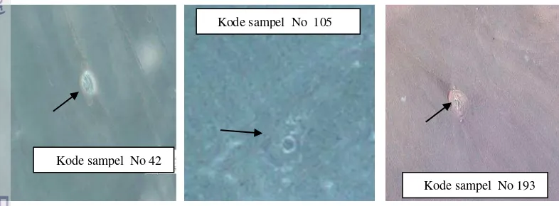 Gambar 8 Larva Trichinella spiralis hasil pemeriksaan metode kompresi 