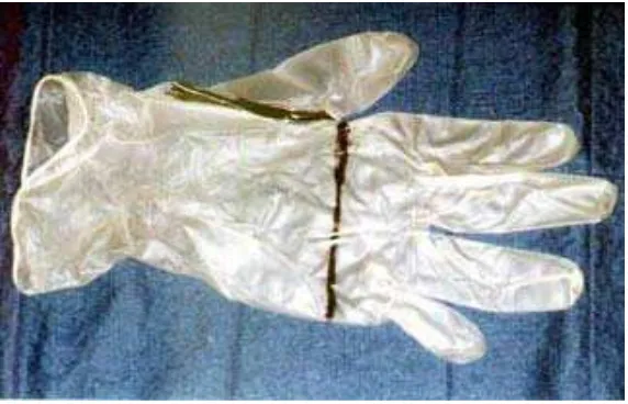 Gambar 6. Sarung tangan vinyl yang digunakan untuk perawatan dental 5