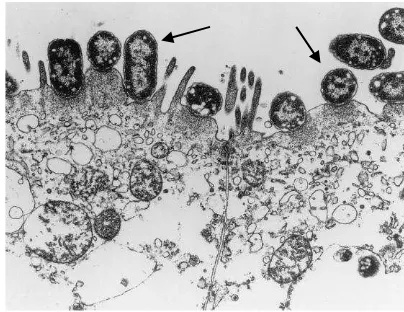 Gambar 2 Perlekatan EPEC (panah) pada membran enterosit dengan kerusakan pada sitoskeleton apikal (Nataro dan Kaper 1998) 