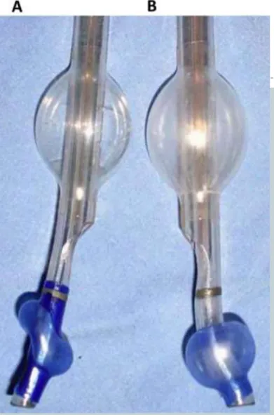 Gambar 2. Sisi kanan (A) dan sisi kiri (B) double-lumen tubes  (Sumber: Isolation of the lung: double-lumen tubes and 
