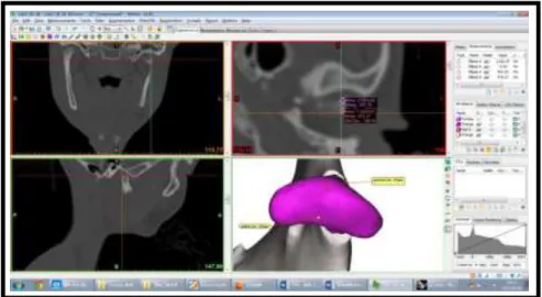 Gambar 9. Radiografi CBCT 17 