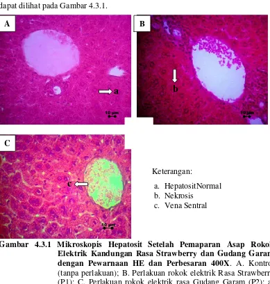 Gambar 4.3.1 Mikroskopis Hepatosit Setelah Pemaparan Asap Rokok 